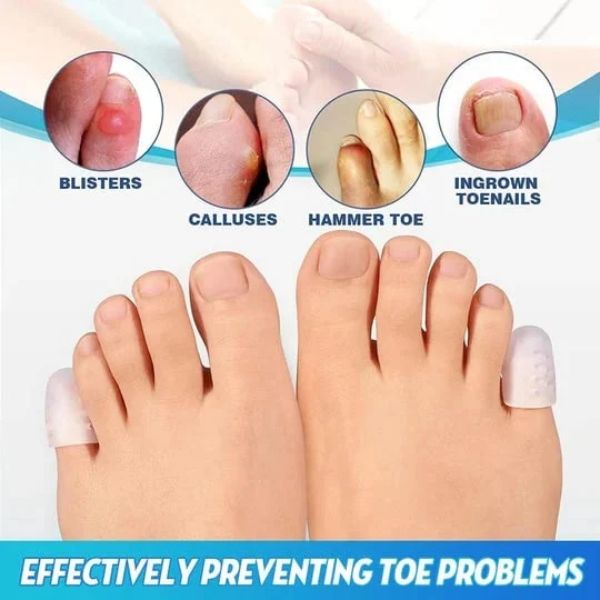 Toe Protector – Protecții pentru degete (10 bucăți) slider