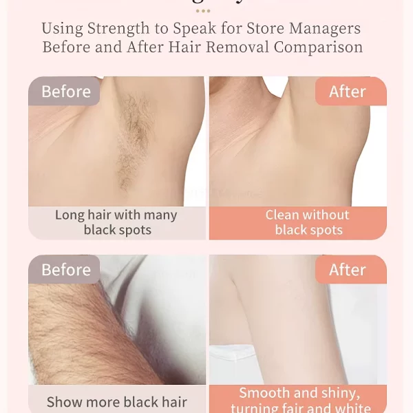 Ladyshave – Aparat de ras electric 2-in-1 pentru femei 03